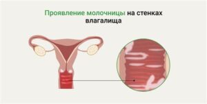 Женские проблемы от недостатка секса: скрытые угрозы для здоровья и отношений