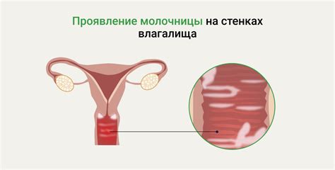 Женские проблемы от недостатка секса: скрытые угрозы для здоровья и отношений