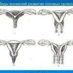 Проблемы по женскому у подростков: причины, симптомы и решение
