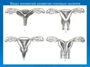 Проблемы после женских операций: как распознать, предотвратить и восстановиться