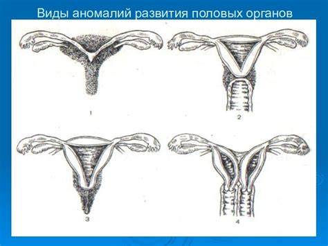 Проблемы после женских операций: как распознать, предотвратить и восстановиться