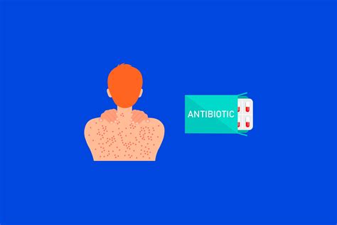 Женская проблема после антибиотиков: причины, симптомы и методы восстановления микрофлоры